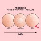 NOLAHOUR CLEAR SPOT PATCH B26 NOLAHOUR CLEAR SPOT PATCH B26